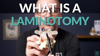 What is a Laminotomy  Spine Surgery Basics [upl. by Clyve553]