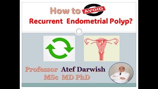 How to avoid Recurrent Endometrial polyp [upl. by Neo]