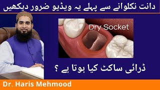 tooth extraction aftercare  Dry Socket  Hindi  Urdu [upl. by Eirrak]