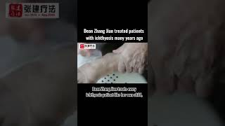 Dean Zhang Jian treated patients with ichthyosis many years ago ichthyosis skincare dryskin [upl. by Primrosa]