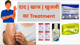 खुजली का इलाज  Khujli ka treatment in hindi  scabies treatment [upl. by Terces]