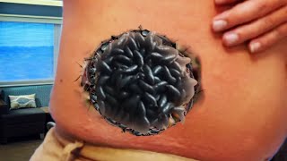 animation Treating the abdomen using ASMR Removing crawlers and larvae from the abdomen [upl. by Atinaujnas]