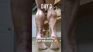 Insane 40 Day Calf Tear Recovery [upl. by Rox]