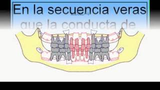 MUELA DEL JUICIO [upl. by Nettie]