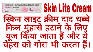 Skin Lite Cream दाद धब्बे और चहरे को गोरा करता हैं। [upl. by Milone372]