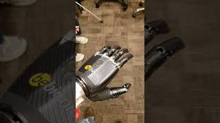 My old BeBionic bionic hand not as good as my new iLimbbionic robot carbonfiber bionichand 2017 [upl. by Inga355]