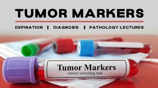 What are tumor MarkersPathologyRobbins lecture pathology robbins lecture [upl. by Mountfort600]