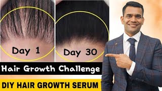 Powerful Hair Growth Serum For Extreme Hair Growth  Regrow Lost Hair Get Double Density in 30 days [upl. by Annawoj]