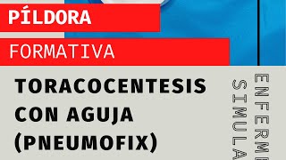 Toracocentesis con aguja Uso del pneumofix [upl. by Peck]