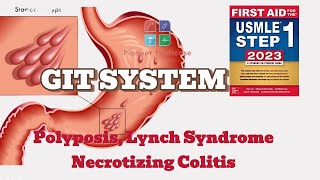 Polyposis Syndrome Lynch Syndrome Necrotizing Colitis first aid step 1USMLEUrduHindi [upl. by Enyrehtak800]