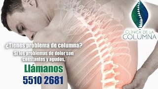 Problema de columna desviada 🏥 escoliosis lumbar [upl. by Grochow]