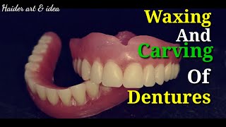 Wax up of complete dentures  Waxing and carving of Complete dentures  How to waxing amp carving [upl. by Nemad536]