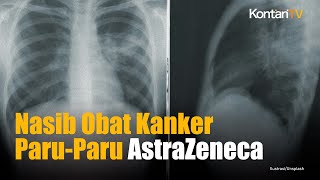 AstraZenecas Umumkan Imfinzi Gagal Uji Tahap Lanjut Mengobati Kanker ParuParu  Kontan News [upl. by Ahsinrat820]