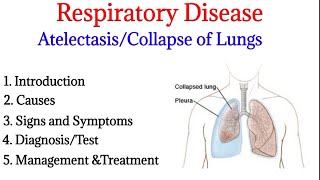 Atelectasis  Introduction causes signs ampsymptoms diagnosis and treatment  Respiratory disease [upl. by Issac442]