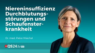 Niereninsuffizienz Durchblutungsstörungen und Schaufensterkrankheit  Dr med Petra Wiechel  QS24 [upl. by Ecinert]