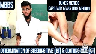 Determination of Bleeding Time BT amp Clotting Time CT  MUHS  mbbs practicals hematology [upl. by Shaff]