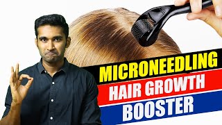 How to do MICRONEEDLING at home for HAIR GROWTHதமிழ் tamil haircare hairgrowth hairloss [upl. by Hoshi572]