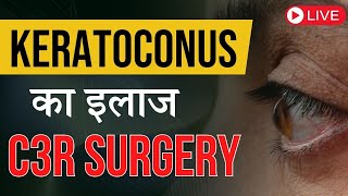 Keratoconus क्या है Keratoconus का क्या इलाज है [upl. by Assirahs]