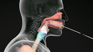 How do Straw Exercises Help the Voice Get Better voicetherapy [upl. by Robins440]