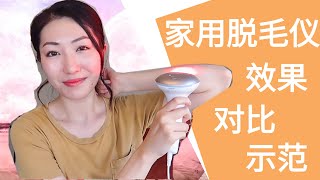 家用脱毛仪测评和示范  Philips Lumea IPL  剃毛刀脱毛膏私密好物推荐 [upl. by Frechette894]