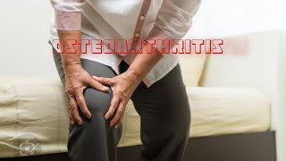 Osteoarthritis  Definition  Causes Treatment [upl. by Naid209]