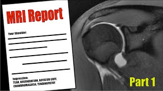 Shoulder PAIN  Understand your MRI Report [upl. by Anreval476]