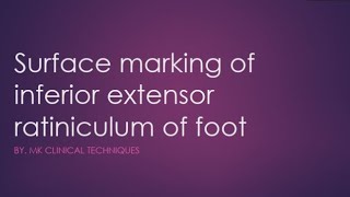 Inferior extensor retinaculum of foot surface marking of inferior extensor retinaculum of foot [upl. by Ira590]