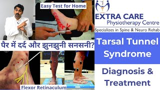 Tarsal Tunnel Syndrome in Hindi  Diagnosis and Treatment  Pain amp Tingling Sensation in Foot [upl. by Lovich277]