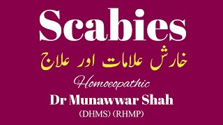 Scabies Itching Eczema  scabies allergy eczema [upl. by Idoj]