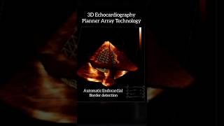 3D Echocardiography  Planner Array Technology makes endocardial border detection easy [upl. by Corabelle]