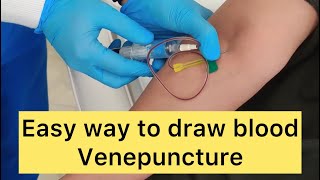 How to draw blood Venepuncture Blood sample for PRP Platelet rich plasma venepuncture blooddraw [upl. by Aver]