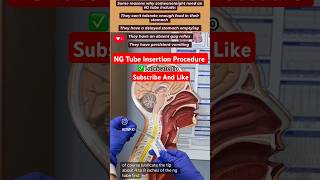 NG Tube Insertion Procedure Emergency icu pharmacynursingdoctor [upl. by Devin576]