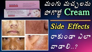 Elosone HT Cream Uses In Telugu  Pigmentation Cream  Melasma  Skin Cream [upl. by Llemor667]