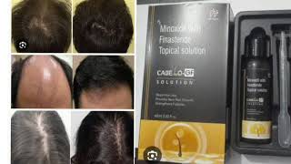 CABELLO GF SOLUTION Minoxidil With Finasteride Topical solution [upl. by Yblehs]