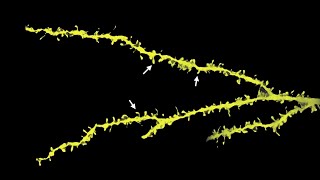 Longterm Memories Are Maintained by Prionlike Proteins [upl. by Raines]