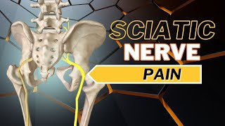 Top 3 Causes of Sciatic Nerve Pain How to Tell What is Causing It [upl. by Carlynne421]