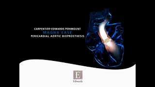 CarpentierEdwards PERIMOUNT Magna Ease aortic valve [upl. by Almallah603]