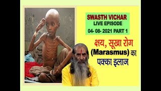 सूखा रोग के लक्षण और आयुर्वेदिक उपचार  Homemade Remedies for Rickets  swasth vichar [upl. by Erkan393]