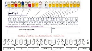 Identification of Gramnegative rod strains members of Enterobacteriaceae using API 20E kit [upl. by Lorak908]