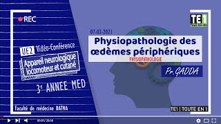 PHYSIOPATHOLOGIE  Physiopathologie des œdèmes périphériques [upl. by Justine]