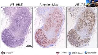 Artificial Intelligence in Pathology [upl. by Attegroeg100]