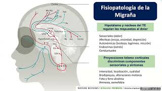 Tratamientos para migraña agudo y preventivo [upl. by Gilder]