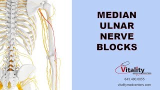 Nerve Blocks to Treat Peripheral Neuropathy of the Arms Hands and Fingers [upl. by Burnard]