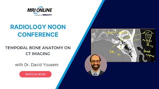 Temporal Bone Anatomy on CT Imaging w Dr David Yousem  Medality MRI Online Radiology Conference [upl. by Burnight]