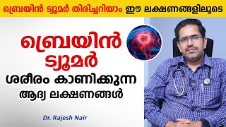 ബ്രെയിൻ ട്യൂമർ ശരീരം കാണിക്കുന്ന ആദ്യ ലക്ഷണങ്ങൾ  Brain Tumor Malayalam  Arogyam [upl. by Sirob]