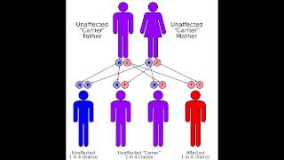 Friedreichs Ataxia  Causes Symptoms amp Mnemonics [upl. by Llerat]