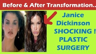 Janice Dickinson Plastic Surgery Before and After Full HD [upl. by Kwok]