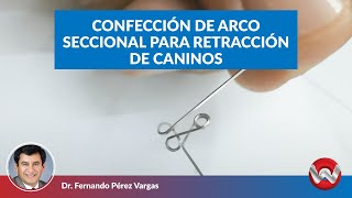 Confección de arco seccional para retracción de caninos [upl. by Regor457]