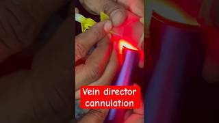 Vein Ditector cannulation  cannula trending injection smpharmacy SMpharmacy plzz subscribe [upl. by Haraz922]