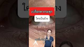 ตากระตุก หมอกิ๊ก จักษุแพทย์ ophthalmologist เปลือกตากระตุก ตากระตุก eyelidtwitch myokymia [upl. by Treacy]